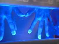 手洗いチェッカーのライトに手をかざした写真です。爪周りに汚れがたくさん見られます